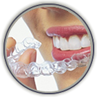 Invisalign Thorndale